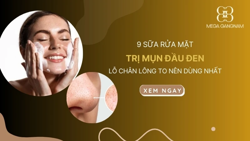 Top 9 sữa rửa mặt trị mụn đầu đen, lỗ chân lông to nên dùng nhất