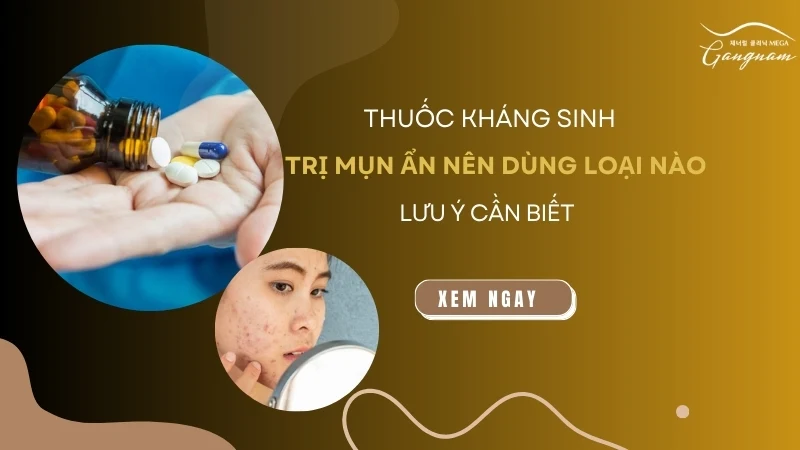 Thuốc kháng sinh trị mụn ẩn nên dùng loại nào? 5+ Lưu ý