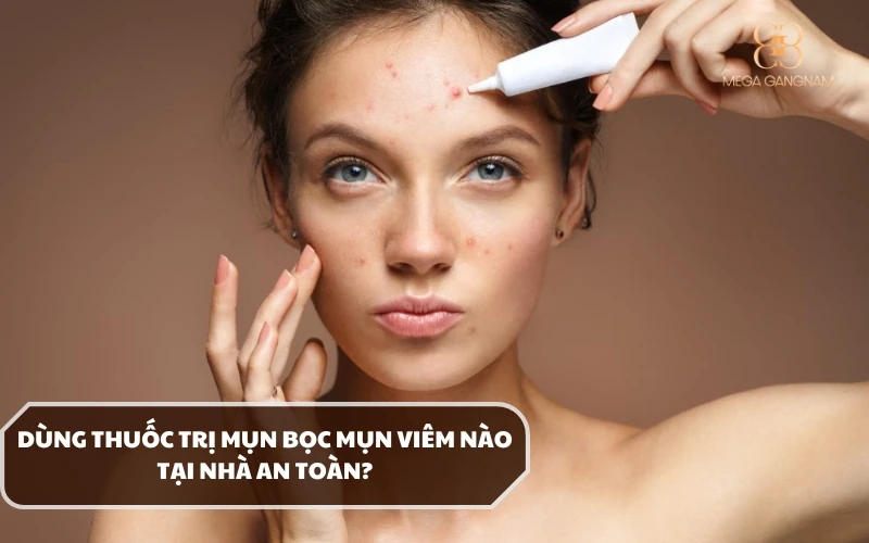 Có nên dùng thuốc trị mụn viêm mụn bọc tại nhà không? Sử dụng loại nào an toàn? 