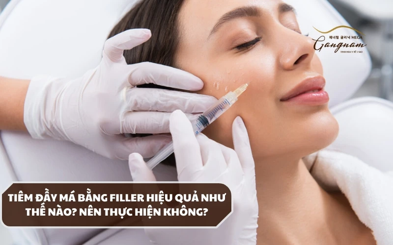 Phương pháp tiêm đầy má bằng filler thực tế là quá trình tiêm tạo hình má phổ biến hiện nay 