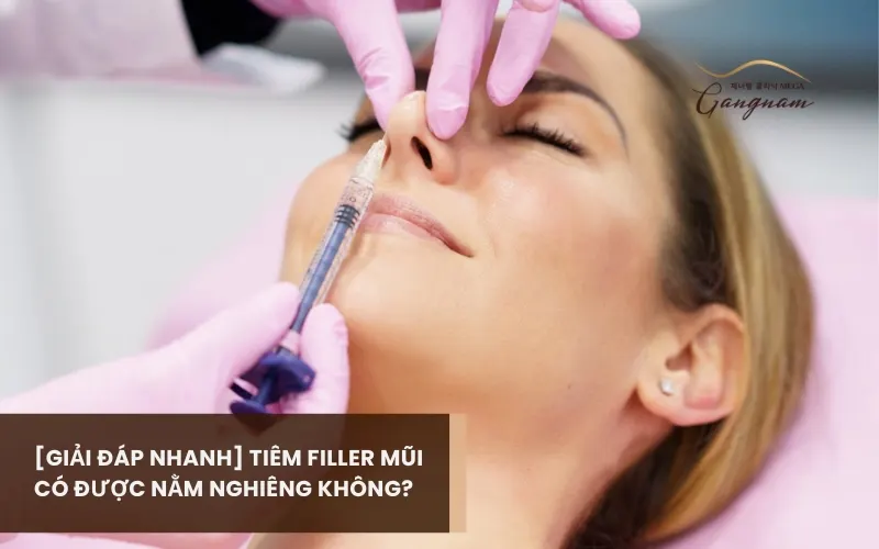 Tiêm filler mũi có được nằm nghiêng không? Những ảnh hưởng của tư thế ngủ đến hiệu quả sau tiêm filler 