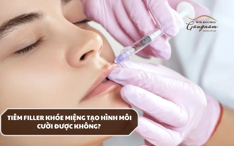 Phương pháp tiêm filler khóe miệng có an toàn không? Có những lợi ích gì? 