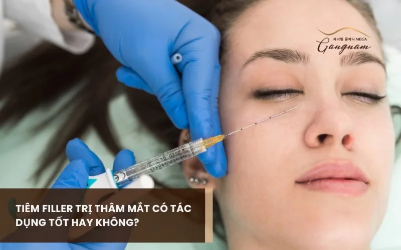 Tiêm filler trị thâm mắt có thật sự hiệu quả? Ai phù hợp với phương pháp này? 