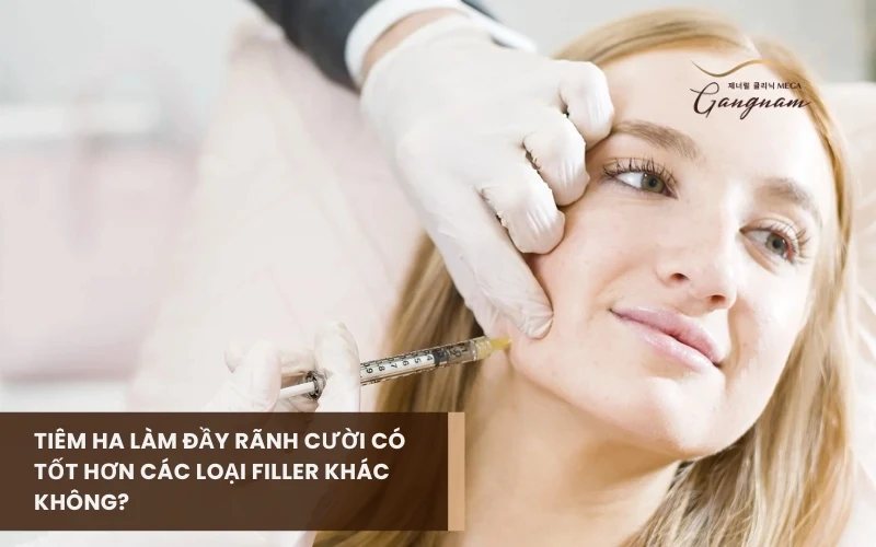 Tiêm HA làm đầy rãnh cười có gì khác so với các loai filler phổ biến? 