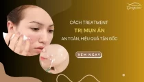 Cách treatment trị mụn ẩn an toàn, hiệu quả tận gốc