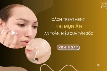 Cách treatment trị mụn ẩn an toàn, hiệu quả tận gốc