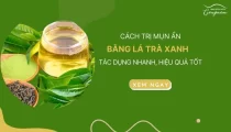 Cách trị mụn ẩn bằng lá trà xanh tác dụng nhanh, hiệu quả tốt