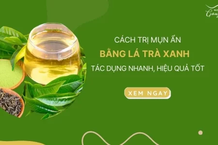 Cách trị mụn ẩn bằng lá trà xanh tác dụng nhanh, hiệu quả tốt