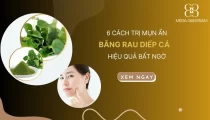 6 cách trị mụn ẩn bằng rau diếp cá hiệu quả bất ngờ