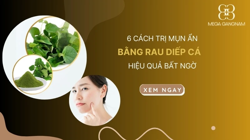 6 cách trị mụn ẩn bằng rau diếp cá hiệu quả bất ngờ