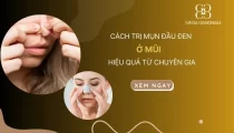 Cách trị mụn đầu đen ở mũi hiệu quả từ chuyên gia