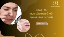 10 cách trị mụn đầu đen ở mũi tại nhà đáng thử nhất