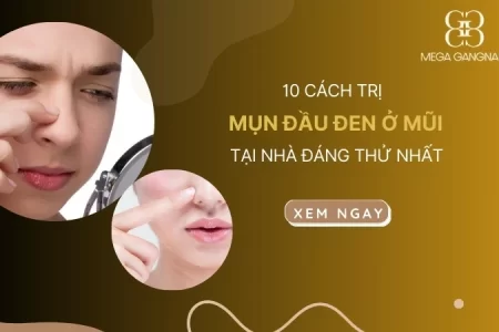 10 cách trị mụn đầu đen ở mũi tại nhà đáng thử nhất