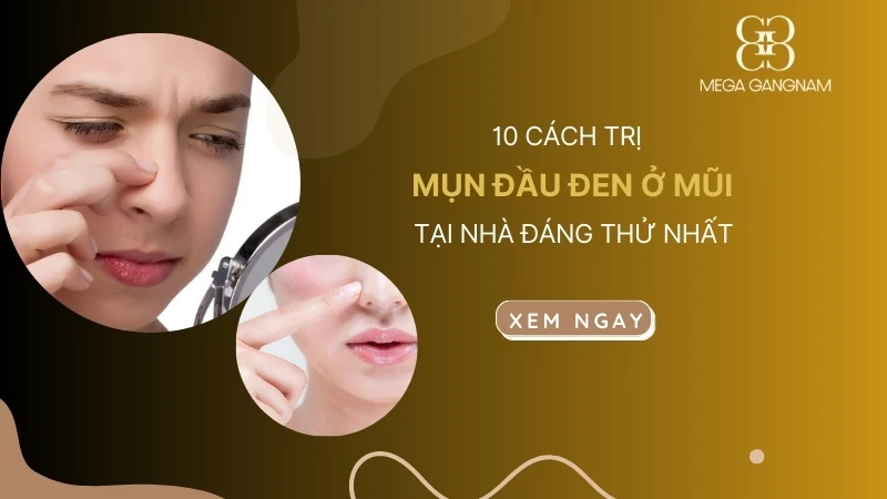 10 cách trị mụn đầu đen ở mũi tại nhà đáng thử nhất