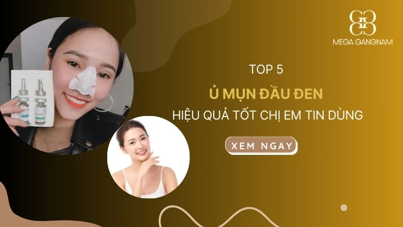 Review 5 ủ mụn đầu đen hiệu quả tốt chị em tin dùng