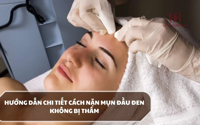 Cách nặn mụn đầu đen không bị thâm tại nhà như thế nào an toàn, đúng phương pháp? 