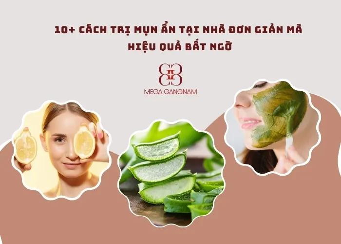 Tổng hợp 10+ cách trị mụn ẩn hiệu quả tại nhà, ai cũng nên biết