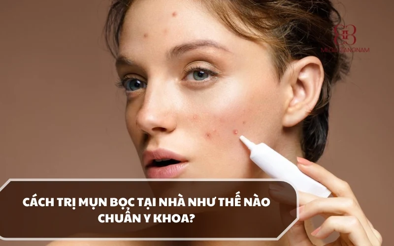 Cách trị mụn bọc như thế nào hiệu quả? Áp dụng phương pháp nào an toàn? 