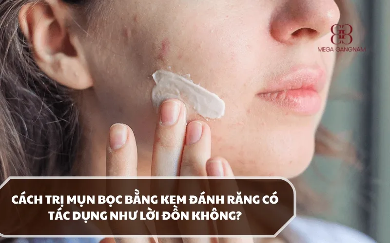 Áp dụng cách trị mụn bọc bằng kem đánh răng có tốt như lời đồn hay không? 