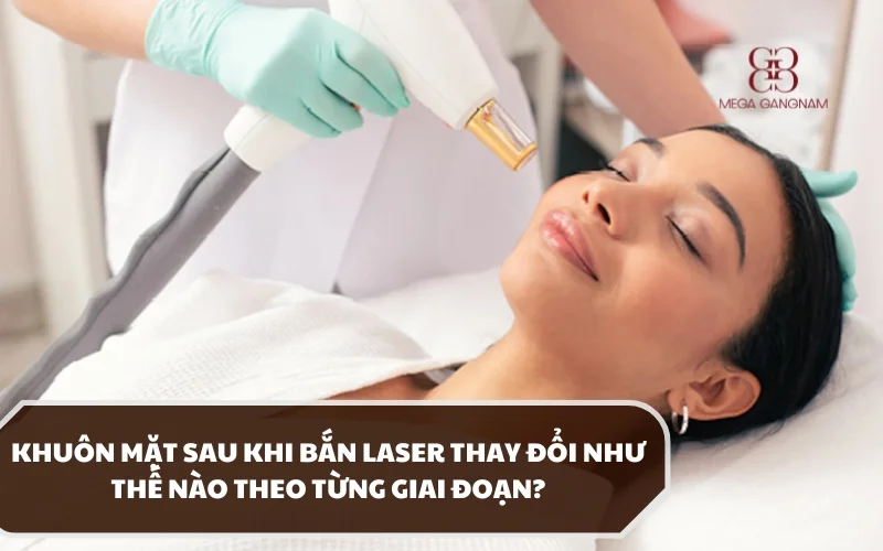 Khuôn mặt sau khi bắn laser có sự thay đổi như thế nào? Chuyển biến này có tốt không? 