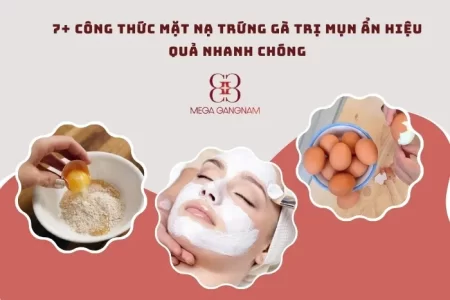 7+ công thức mặt nạ trứng gà trị mụn ẩn hiệu quả nhanh chóng