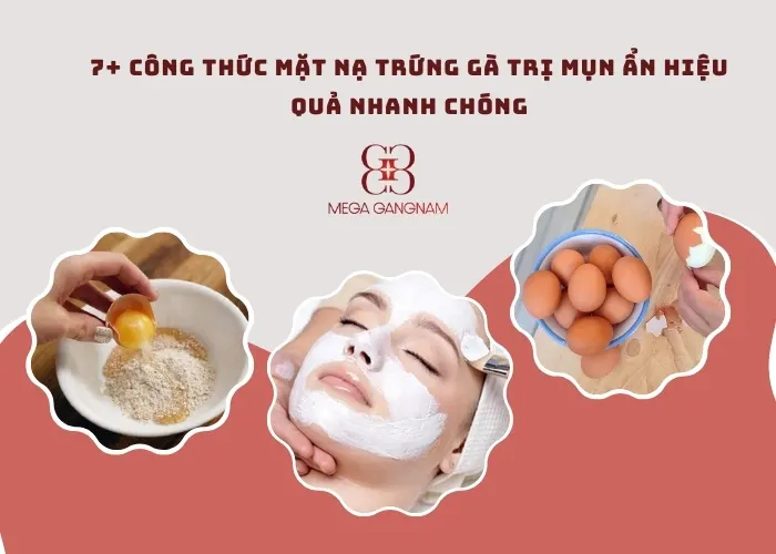 7+ công thức mặt nạ trứng gà trị mụn ẩn hiệu quả nhanh chóng