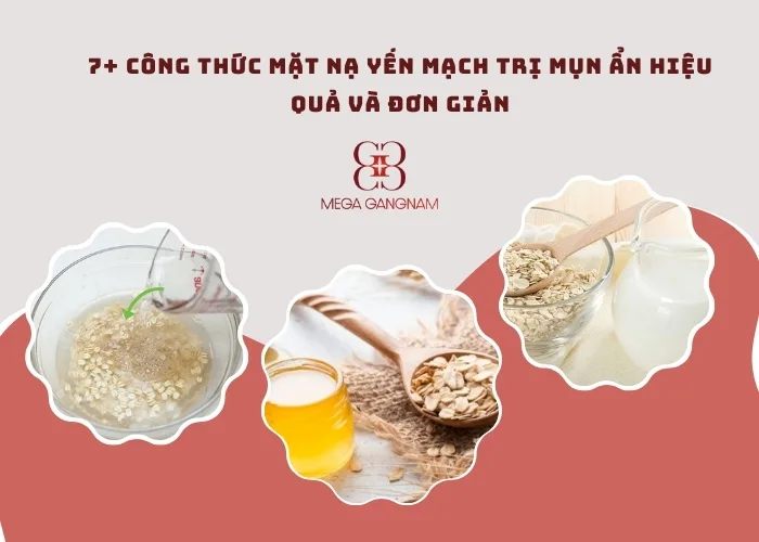 7+ công thức mặt nạ yến mạch trị mụn ẩn hiệu quả và đơn giản