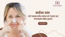 Miếng dán lột mụn đầu đen có thực sự trị mụn hiệu quả?