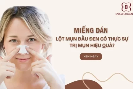 Miếng dán lột mụn đầu đen có thực sự trị mụn hiệu quả?