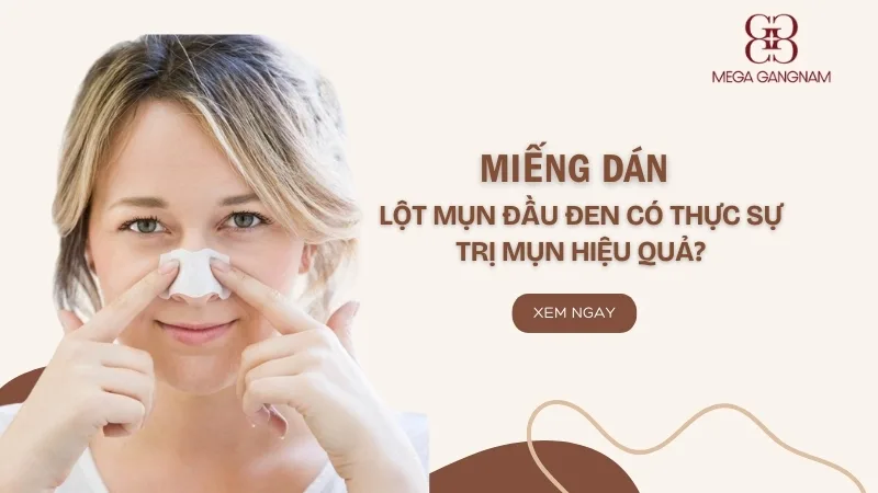 Miếng dán lột mụn đầu đen có thực sự trị mụn hiệu quả?