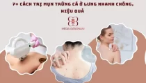 Cách trị mụn trứng cá ở lưng hiệu quả, an toàn