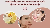 Cách điều trị mụn trứng cá tuổi dậy thì