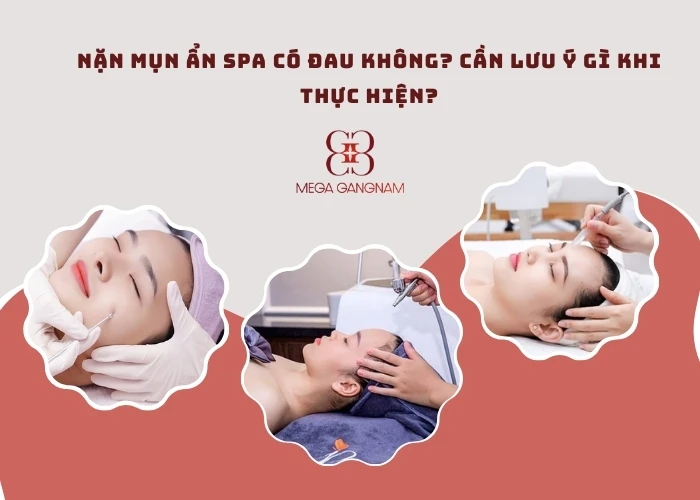 Nặn mụn ẩn spa có đau không?