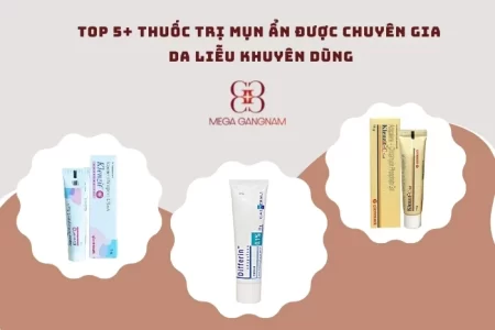 Top 5 thuốc trị mụn ẩn phổ biến, được yêu thích nhất hiện nay