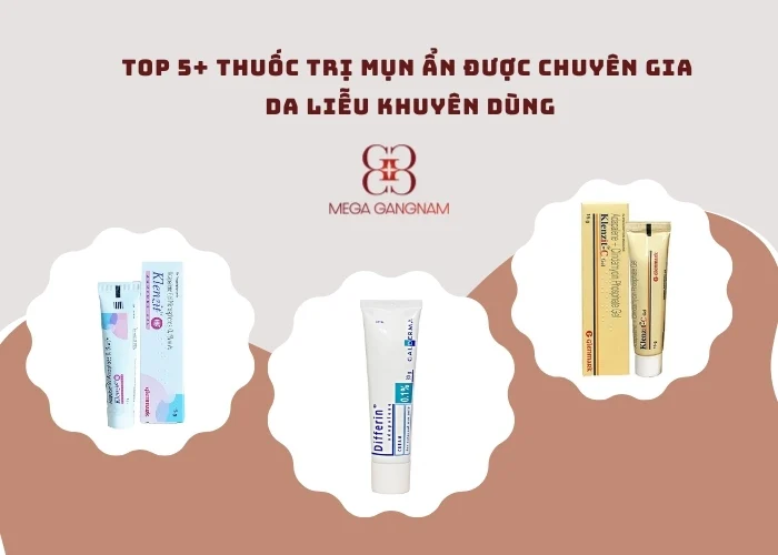 Top 5 thuốc trị mụn ẩn phổ biến, được yêu thích nhất hiện nay