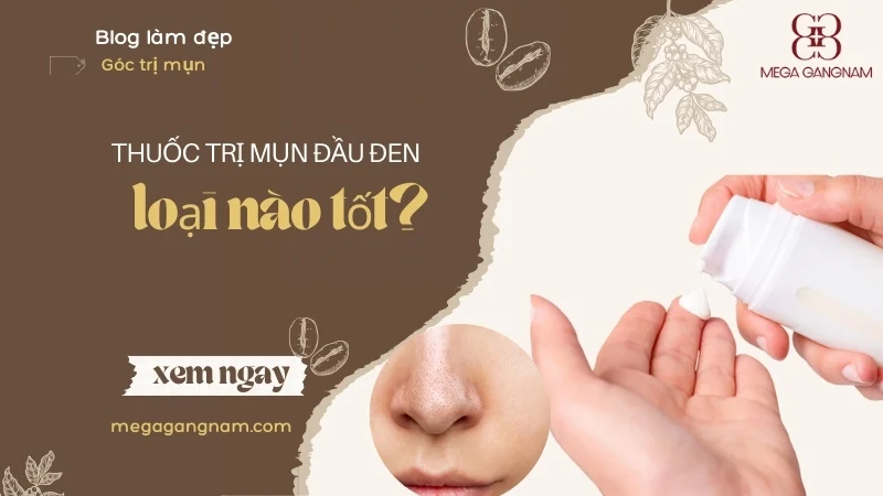 Dùng thuốc trị mụn đầu đen nào hiệu quả tốt?