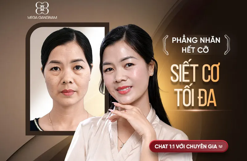 Rãnh cười, nếp nhăn nông sâu đều được giải quyết với các công nghệ trẻ hóa hàng đầu tại Mega Gangnam. 