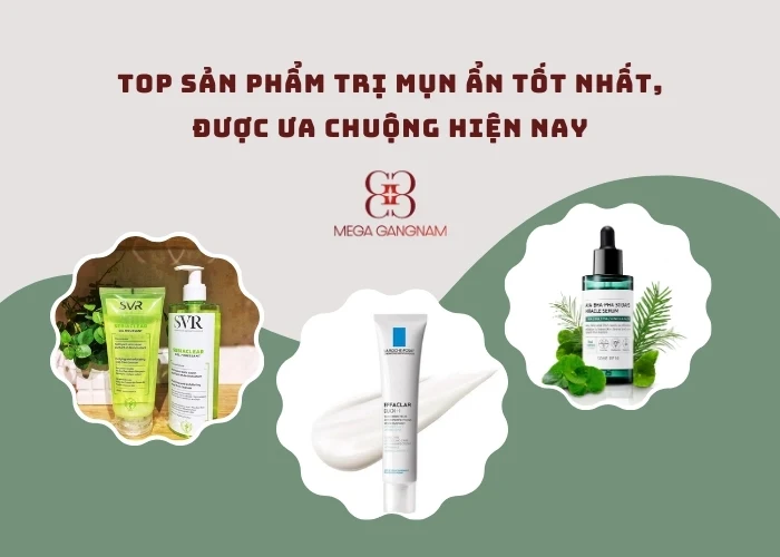 Top sản phẩm trị mụn ẩn tốt nhất, được ưa chuộng hiện nay