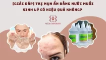 Trị mụn ẩn bằng nước muối sinh lý có hiệu quả không? 