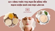 12+ công thức trị mụn ẩn bằng yến mạch hiệu quả cho mọi làn da