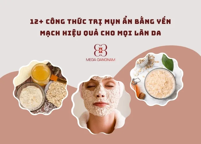 12+ công thức trị mụn ẩn bằng yến mạch hiệu quả cho mọi làn da