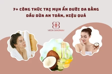 7+ công thức trị mụn ẩn dưới da bằng dầu dừa an toàn, hiệu quả