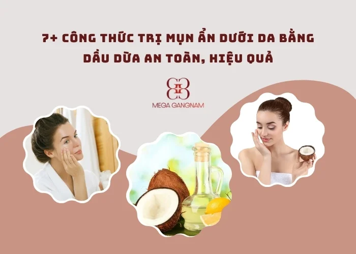 7+ công thức trị mụn ẩn dưới da bằng dầu dừa an toàn, hiệu quả