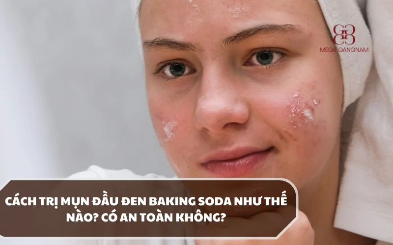 Trị mụn đầu đen baking soda hiệu quả có tốt không và cách thực hiện như thế nào? 