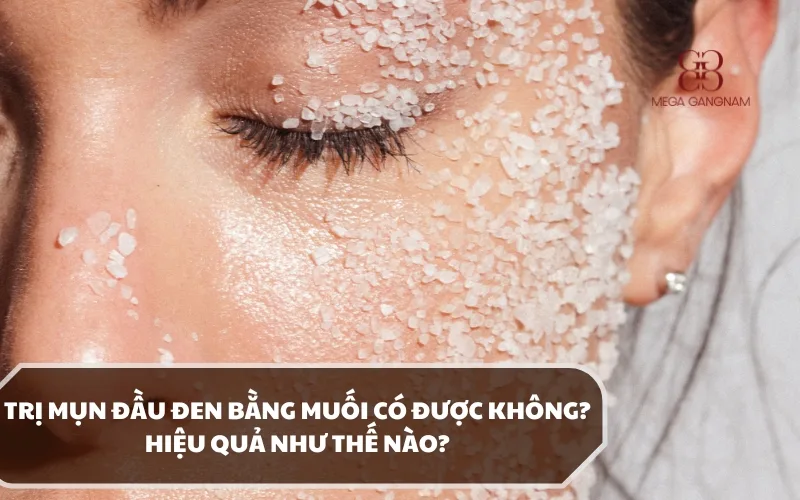 Điều trị mụn đầu đen bằng muối có an toàn không? Cách thực hiện như thế nào? 