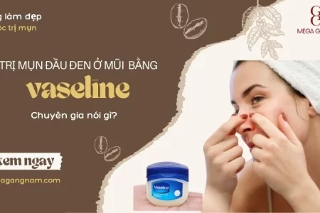 Trị mụn đầu đen ở mũi bằng vaseline: Chuyên gia nói gì? 