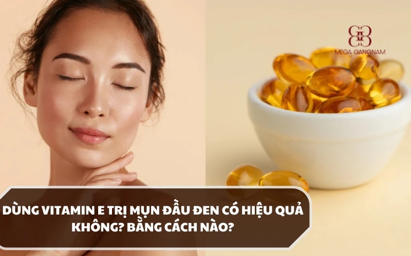 Hướng dẫn các cách dùng vitamin E trị mụn đầu đen và đánh giá về hiệu quả 