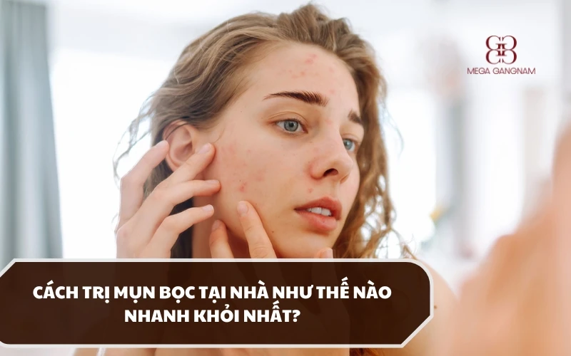 Có nên áp dụng cách trị mụn bọc tại nhà hay không và bằng phương pháp gì? 