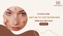 5 cách làm mặt nạ tự chế trị đốm đen trên da hiệu quả