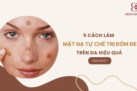 5 cách làm mặt nạ tự chế trị đốm đen trên da hiệu quả